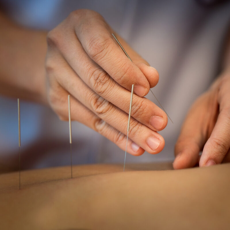 PÓS-GRADUAÇÃO EM ACUPUNTURA