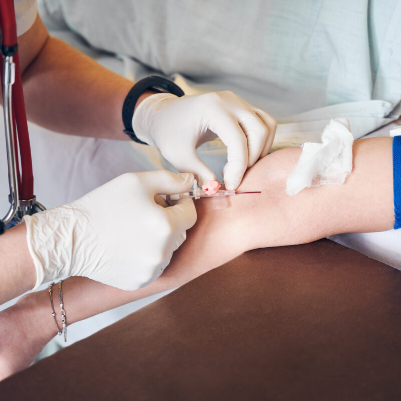 PÓS-GRADUAÇÃO EM ENFERMAGEM EM ANESTESIOLOGIA